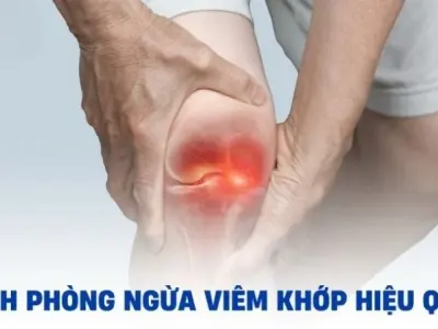 Làm thế nào để phòng ngừa viêm khớp hiệu quả nhất?