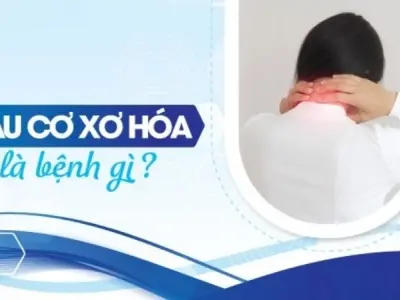 Tại sao đau cơ xơ hóa lại khó chẩn đoán chính xác?