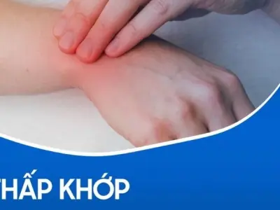 Tại sao bệnh thấp khớp ảnh hưởng đến nhiều cơ quan?