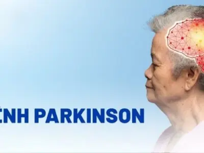 Triệu chứng của bệnh Parkinson là gì và có dễ nhận biết?