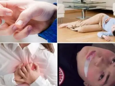 Triệu chứng của động kinh là gì và cách nhận biết sớm