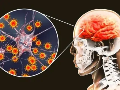 Triệu chứng cảnh báo viêm não nguy hiểm không nên bỏ qua
