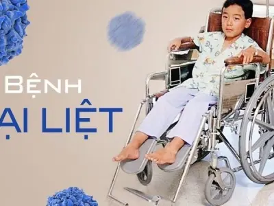 Triệu chứng của bệnh bại liệt là gì và dễ nhận biết không?