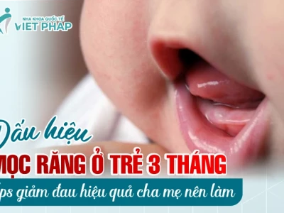 Dấu hiệu mọc răng ở trẻ 3 tháng tuổi và cách chăm sóc