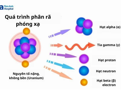 Phóng xạ là gì? Khám phá bản chất và tác động đến sức khỏe con người