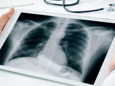 X-ray là gì? Khám phá kỹ thuật chẩn đoán hình ảnh cốt lõi